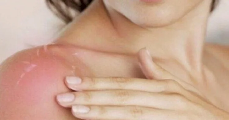 “Yayda sağlam insanların belə ehtiyatlı davranması vacibdir” Həkim