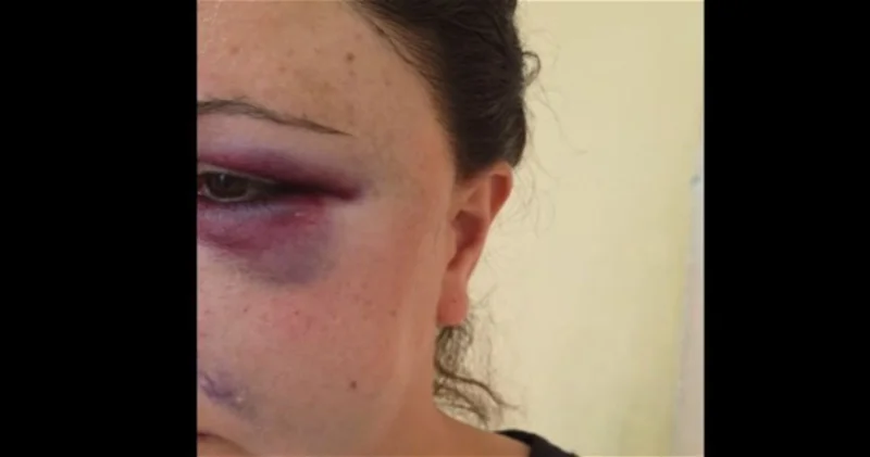 Женщина рассказала о 14 годах домашнего насилия: Родители говорили, что все женщины становятся жёнами через побои ВИДЕО