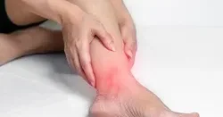 Bu xəstəliyin əlamətləri ağrı, hərəkətdə sərtlik, oynaq nahiyəsində şişkinlik və xırıltıdır