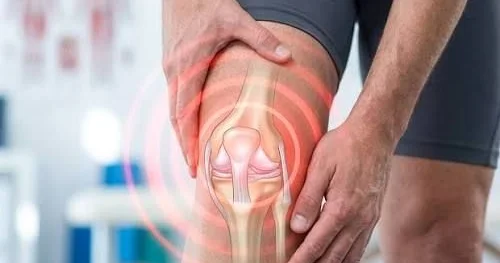 Diz artrozunda əməliyyatsız inteqrativ müalicə: 12 illik diz ağrılarından xilas oldu