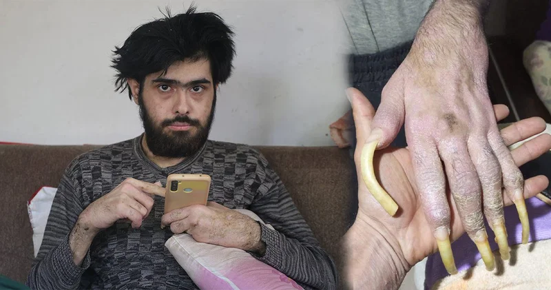 Rəqəmsal asılılıq və sosial təcrid Barış Özbay