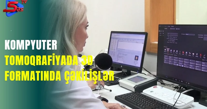 Kompyuter tomoqrafiyada 3D formatında çəkilişlər