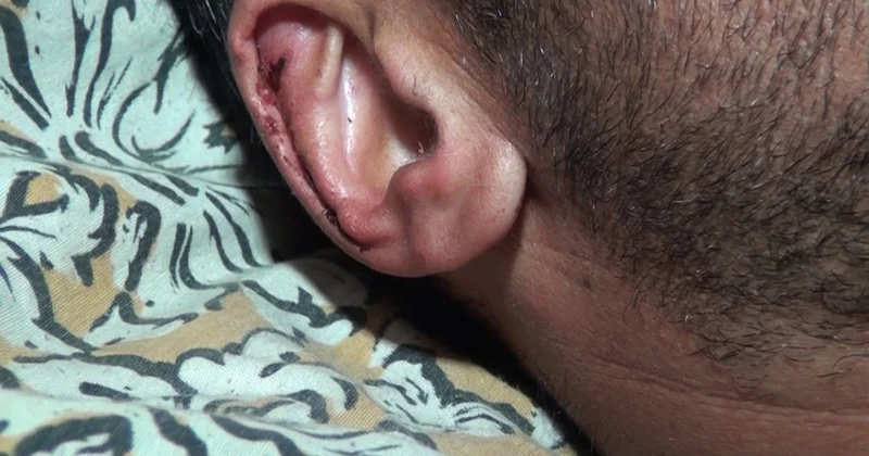 Ayı heyvan otaran Quba sakininə xəsarət yetirib FOTO