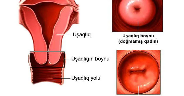 Servikal kanal (uşaqlıq boynu) seliyinin müayinəsi