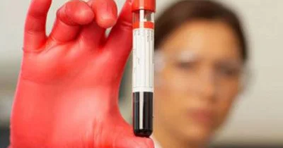 Rezus faktor üzrə ana və döl qanının uyğunsuzluğu