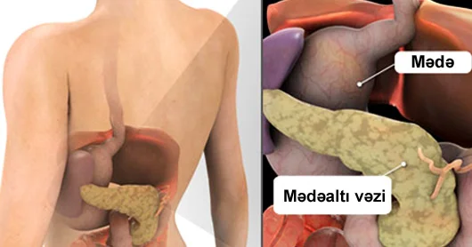 Mədəaltı vəzinin sağlam qalması üçün 5 MƏSLƏHƏT