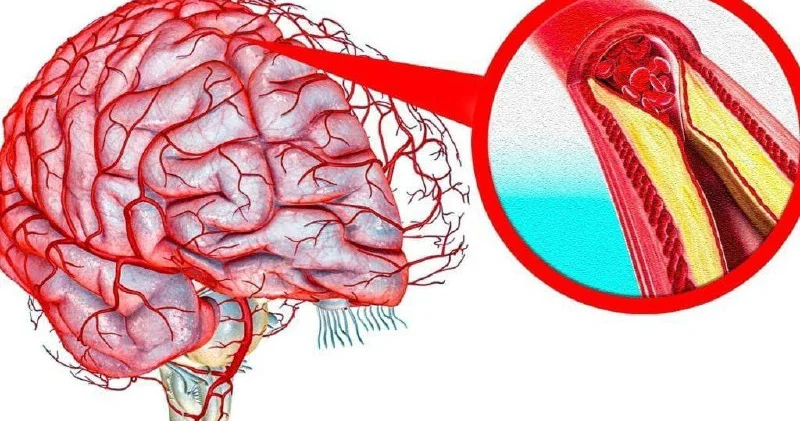 Qan damarları elastikləşir, başgicəllənmə yox olur Bu resepti SINAYIN!