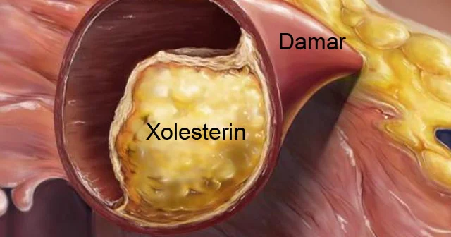 Xolesterini dərmansız aşağı salmağın 3 təbii üsulu