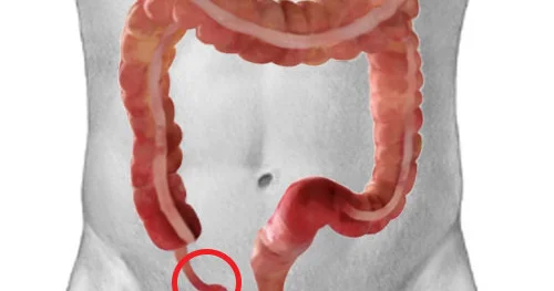 Appendiks nə üçün lazımdır?