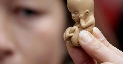 İslamda abort etdirməyə icazə verilirmi?
