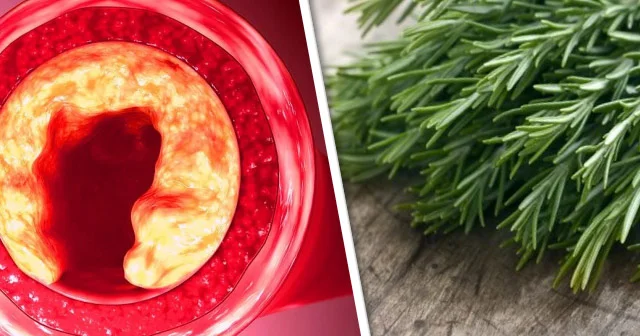 Xolesterini salan, damarları təmizləyən 5 TƏBİİ VASİTƏ. Hər mətbəxdə tapılacaq