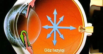 Göz təzyiqi nədir?