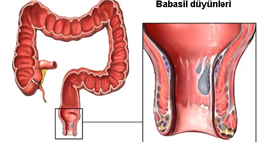 Özünüzü babasildən qoruyun