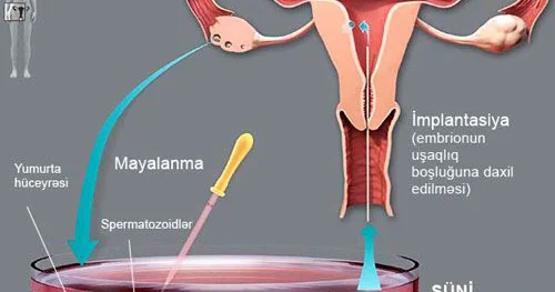 Yumurta hüceyrəsi donorluğu