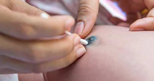 Körpənin göbəyinə necə qulluq etməli? Pediatr məsləhətləri