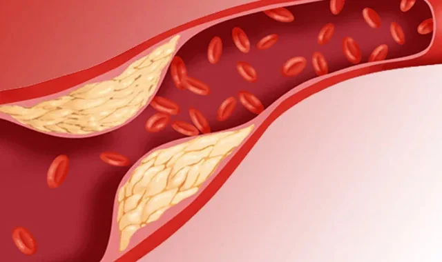 Damarları xolesterindən təmizləyən MADDƏ