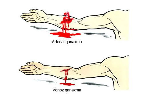 Qanaxma zamanı ilk tibbi yardım
