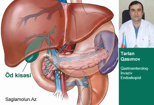 Öd kisəsində qatılaşma öd daşı xəstəliyinə yol açır!