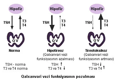 Qalxanvari vəzi fəaliyyətinin artması və onun simptomları