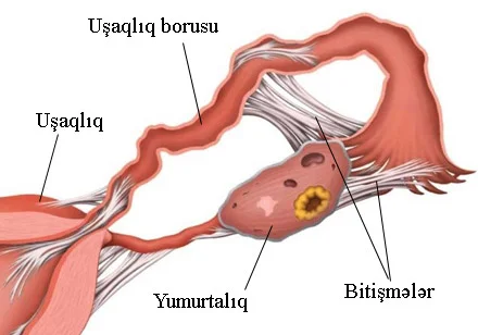 Bitişmələr sonsuzluğun səbəbi