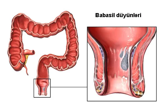 Özünüzü babasildən qoruyun