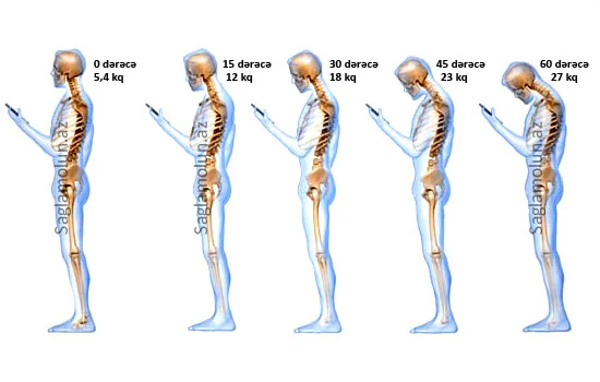 Ayaqüstdə əldə telefon tutmaq bədənə 27 kqlıq təzyiqdir