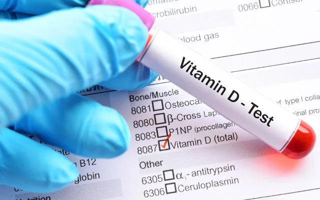 D vitamini əskikliyindən yaranan 10 XƏSTƏLİK