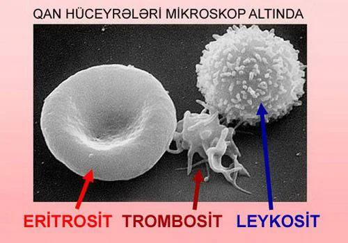 Uşaqlarda trombositopatiyalar