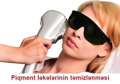 Piqment ləkələri ilə mübarizə