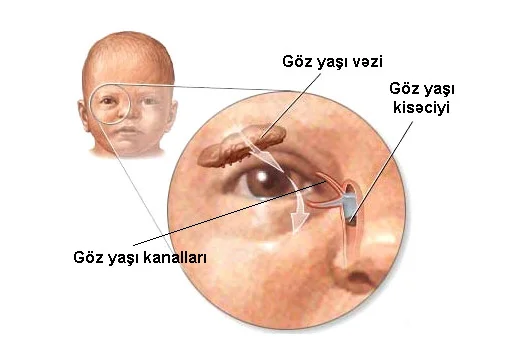 Körpənin gözlərindən irin axır. Nə etmək lazımdır? VİDEO