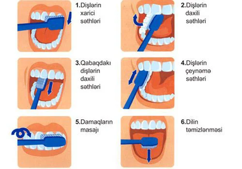 Siz dişlərinizi düzgün təmizləyirsinizmi?