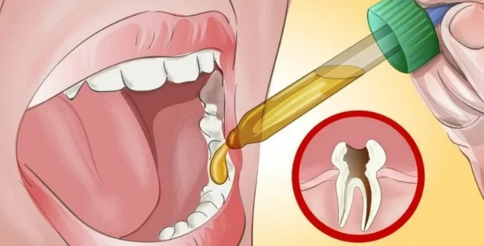 Diş həssaslığı olanlar bunları bilməlidir: Ağrıları azaldan təbii üsullar
