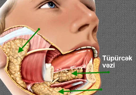 Tüpürcək vəzi şişləri