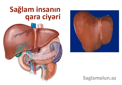 Qara ciyərinizin sağlam olduğunu TESTLƏ yoxlayın