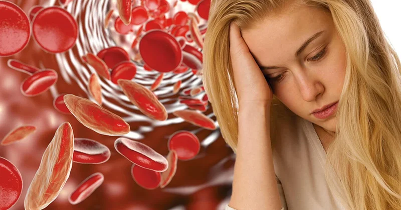 Anemiya yarada biləcək xəstəlik açıqlanıb