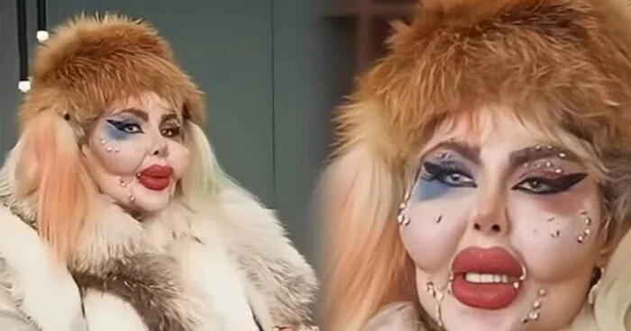 Anahita 388 kosmetik əməliyyat keçirdi