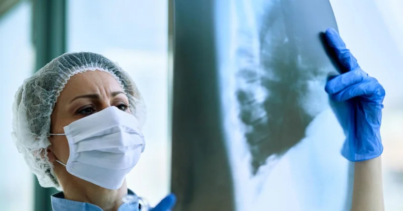 Как эпидемиологи борются с туберкулезом?