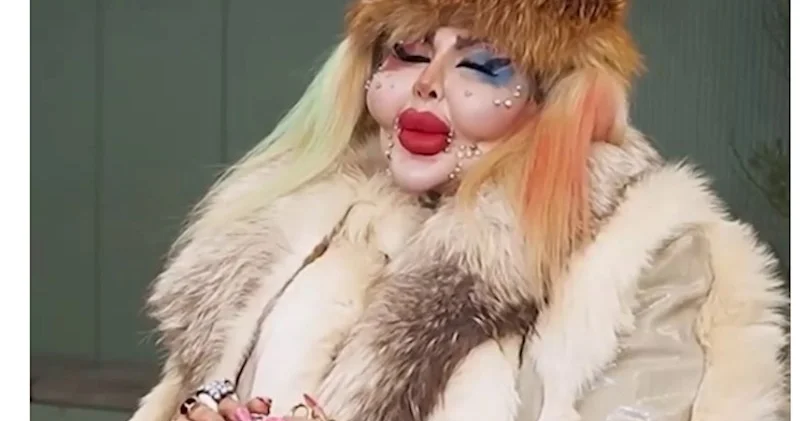 İranlı bloger estetik əməliyyatları ilə Rekordlar Kitabına DÜŞDÜ