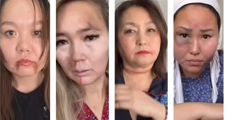 Синяки как манифест: учителя в Актау выступили против насилия