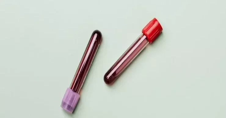 Alimlər təəccüblənirlər Bu qan qrupundan olanlar uzunömürlü olurlar