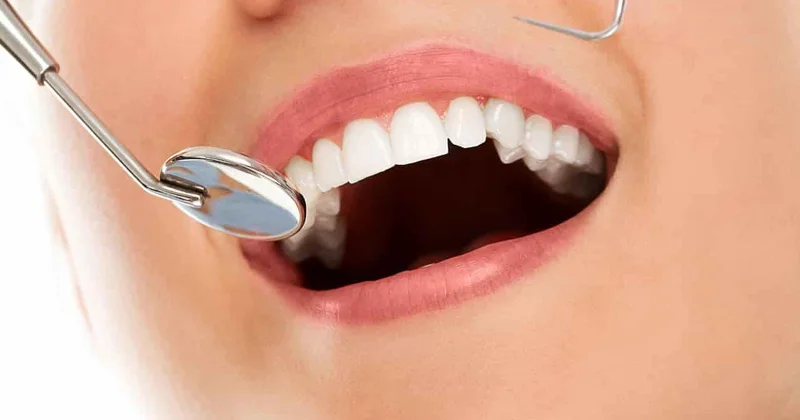 Dişlərin sayı və vəziyyəti ömür uzunluğuna təsir edir ARAŞDIRMA