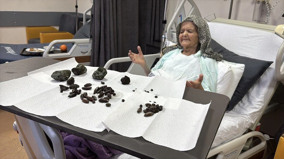 92 yaşlı qadının mədəsindən çıxanlar hər kəsi şoka saldı FOTO