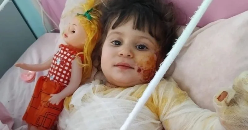 Ağır yanıq xəsarətləri alan Zəhranın anası: Balamın qarşısında çox çarəsizəm