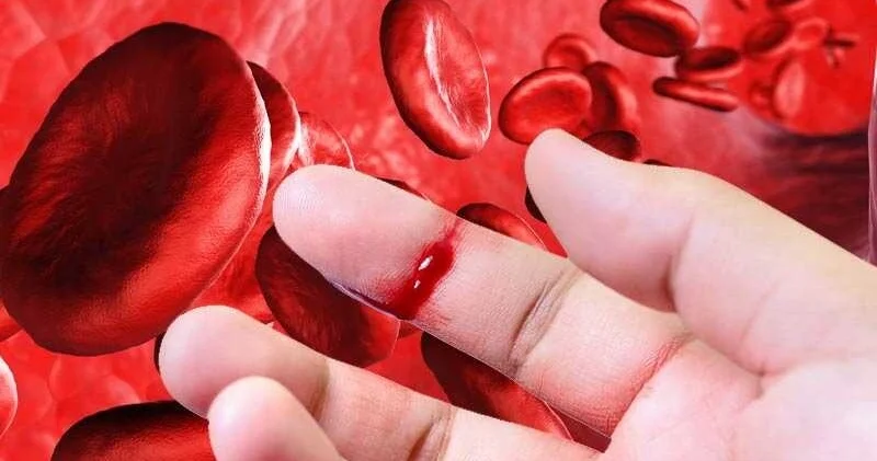 “Hemofiliya: irsi xəstəlik yoxsa idarə oluna bilən vəziyyət?” Ekspert açıqladı
