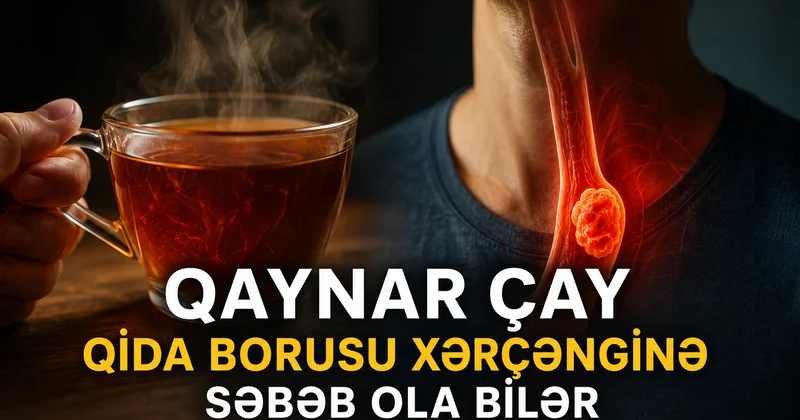Buna diqqət etməmək faciədir