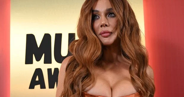 Cərrah Anna Sedokovanın plastik əməliyyatı ilə bağlı həqiqəti açıqlayıb