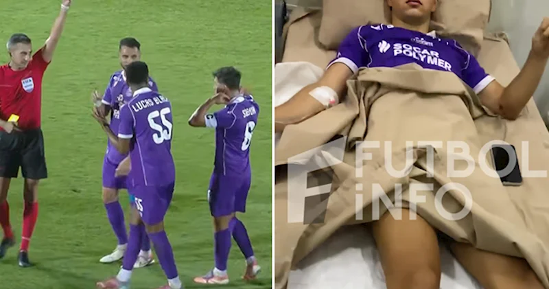 KİV: “Sumqayıt”ın kapitanının ayaq vətərləri kəsilib Kayerasını bitirə bilər?