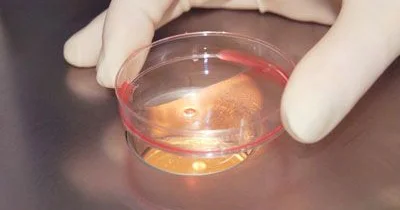 Spermanın və uşaqlıq boynu seliyinin uyğunluğu sınağı (Şuvarski testi)