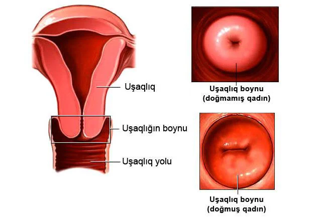 Servikal kanal (uşaqlıq boynu) seliyinin müayinəsi