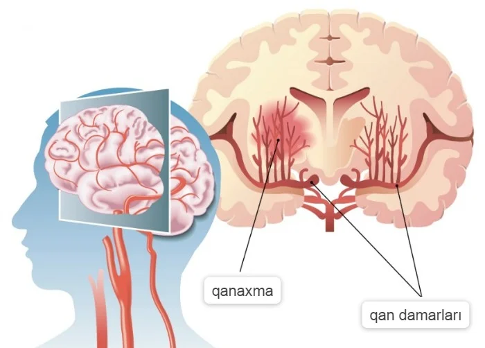 Beyin damarlarına qan axınını təmin etmək üçün TƏBİİ RESEPTLƏR